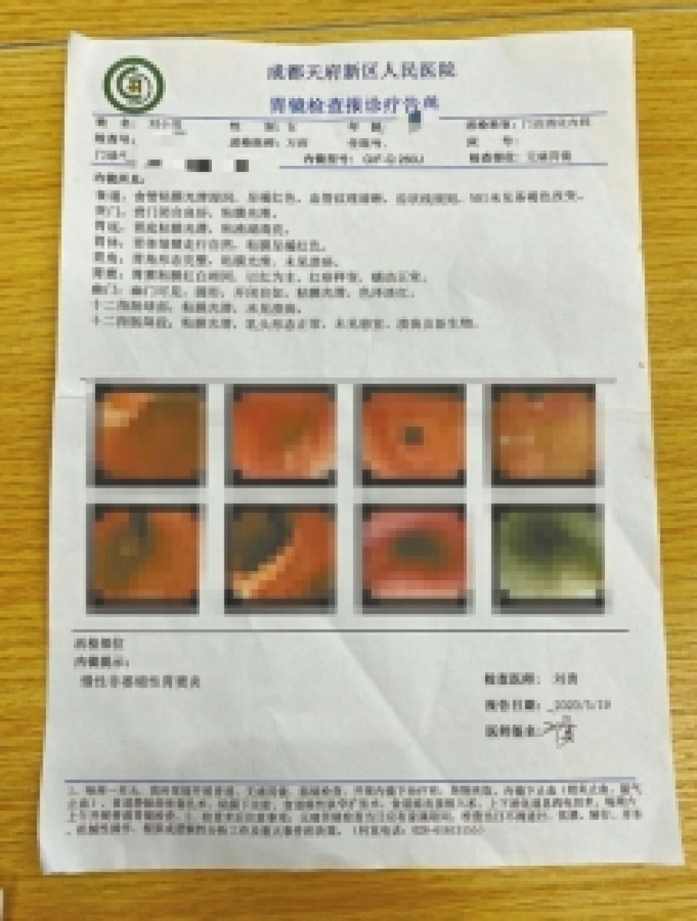 被公司惩罚吃"死神辣条" 两女员工进了医院 ↑刘小雪的胃镜检查报告